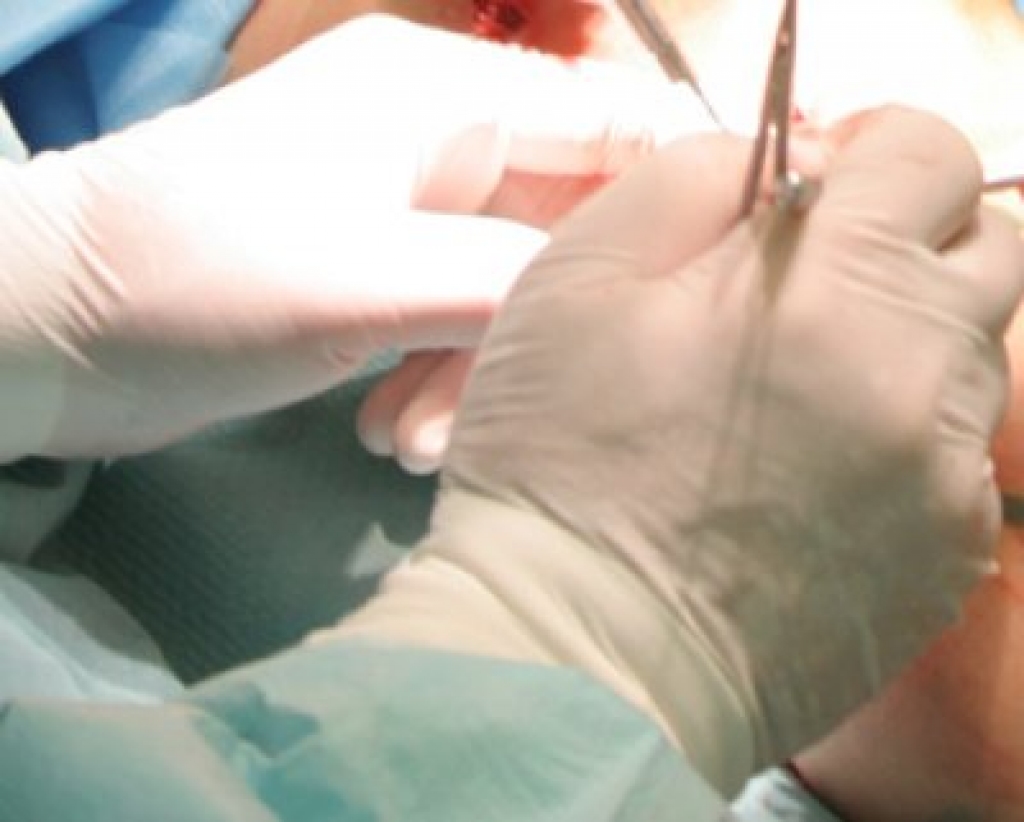 Mikroķirurgi zēnam piešuj gandrīz pilnībā amputētu kāju