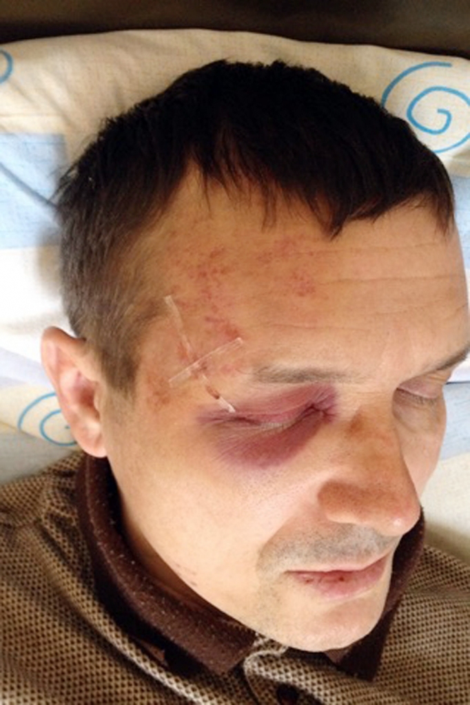 Kriminālseriāla cienīgs mājupbrauciens: Šoferis apsūdz policistu vardarbībā